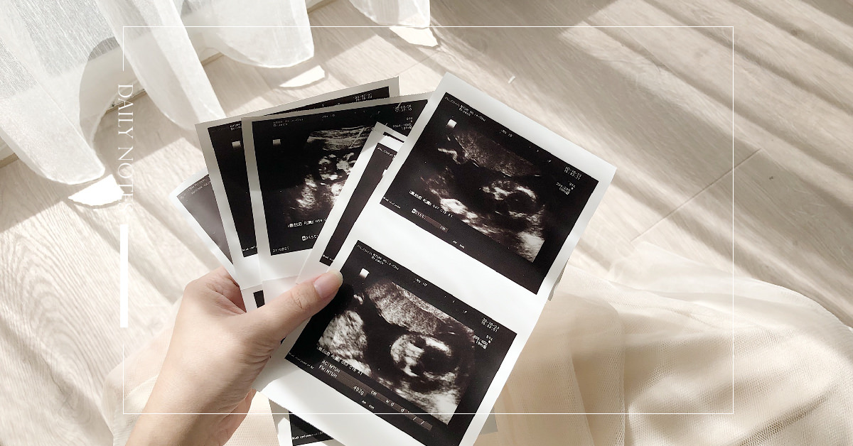 DN工作區域 1-100